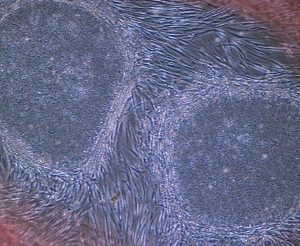 iPS hücreleri