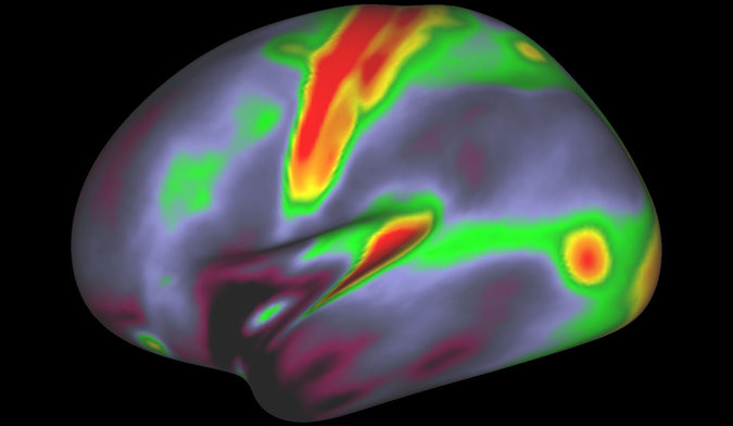 Beyin serebral korteksinin sol yarıküresi. Yüksek miktarda myelin bulunan yerler kırmızı ve sarıya gösterilmiş. Az miktarda bulunan yerler ise mavi ve çivit rengiyle. @Matthew F. Glasser, David C. Van Essen