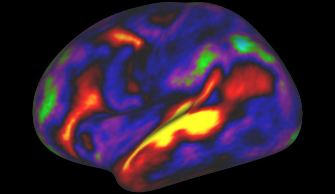 Tarayıcıya bağlıyken hikaye dinleyen bir kişinin beynin sol yarıküresindeki beyin aktivasyonu gösteren bir beyin taraması. @Matthew F. Glasser, David C. Van Essen