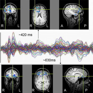 brain-functional-shiftkjh